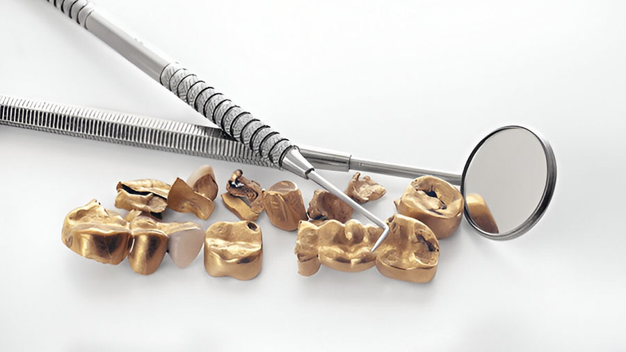 Precious Metal Alloys In Dental Frameworks Precious Metal Alloys In Dental Frameworks