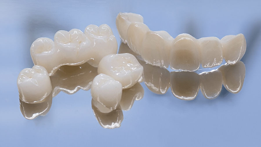 Revolutionizing Dentistry with Polycrystalline Ceramic Frameworks