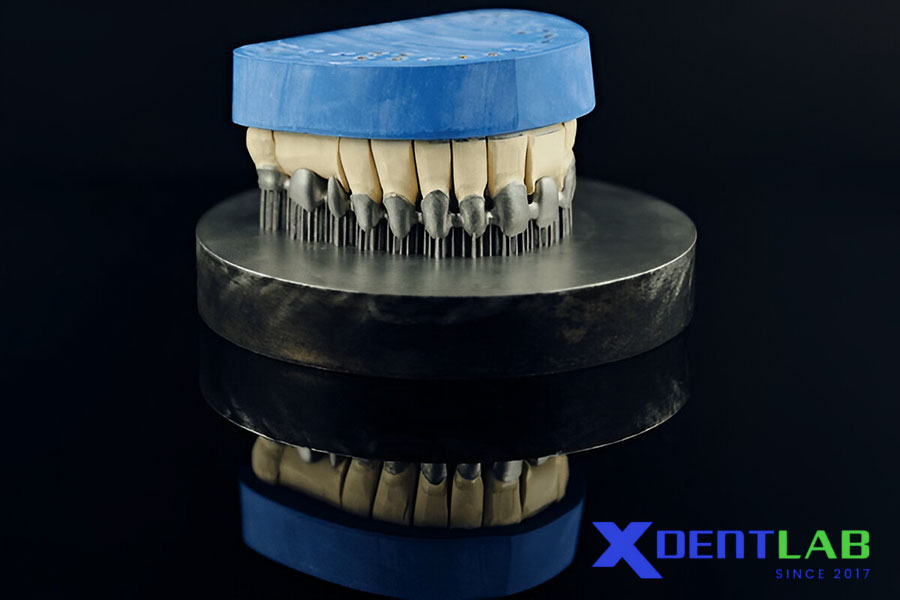 Clinical Applications of Titanium Frameworks
