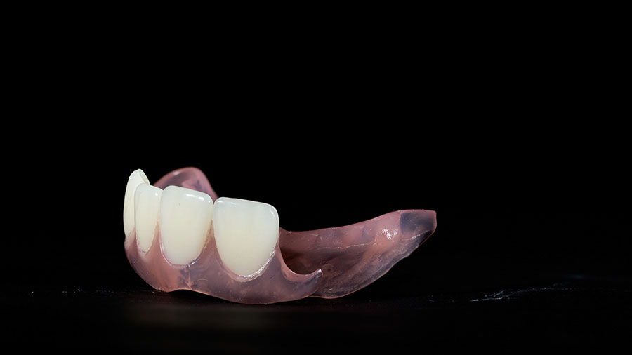 Advantages Of Polymer-Based Frameworks In Modern Dentistry