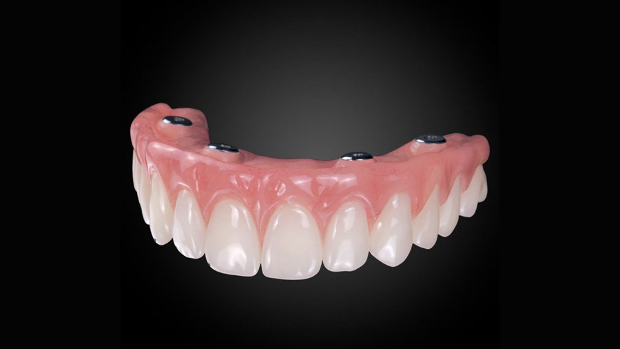 dental-lab-outsourcing-key-trends-for-2025