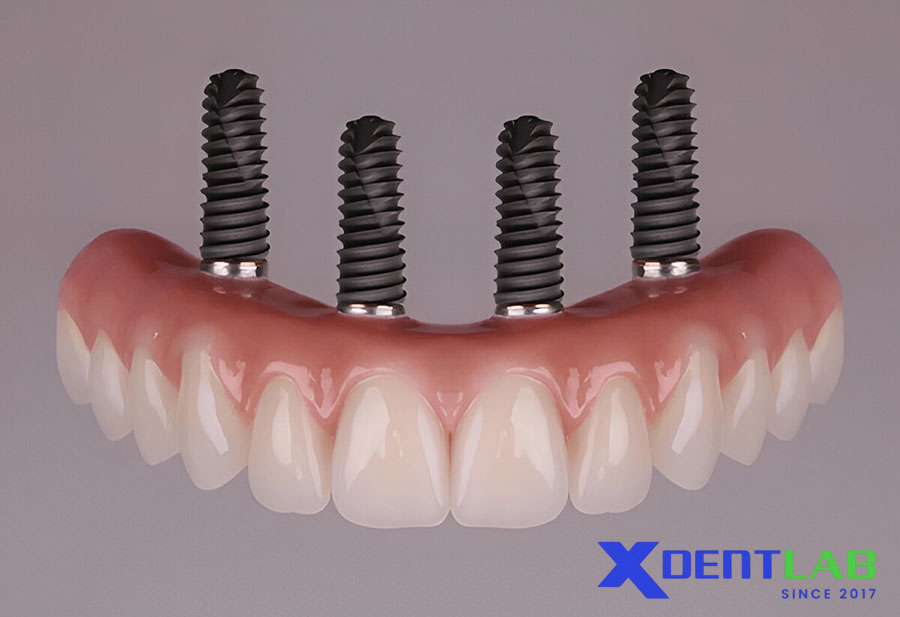 Applications in Polymer-Based Dental Frameworks Applications in Polymer-Based Dental Frameworks