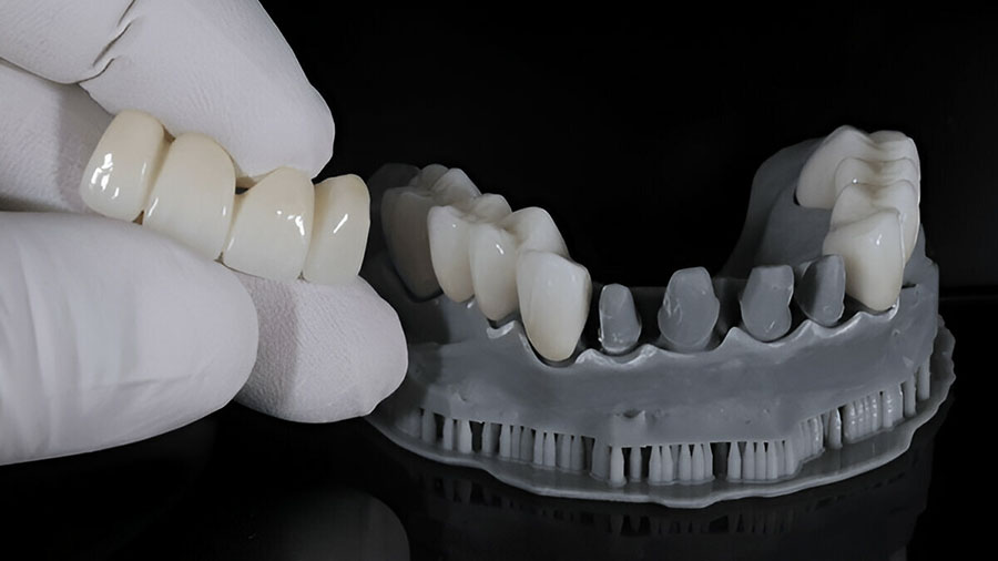 dental-lab-outsourcing-key-trends-for-2025