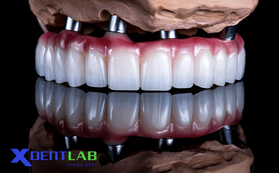 Ưu Điểm Trong Ứng Dụng Nha Khoa Ưu Điểm Trong Ứng Dụng Nha Khoa