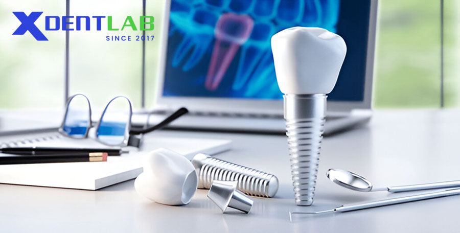 Key Properties of Implant Materials Key Properties of Implant Materials