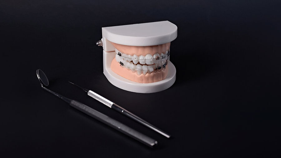 Orthodontic Materials: Innovations, Applications, And Future Trends Orthodontic Materials: Innovations, Applications, And Future Trends