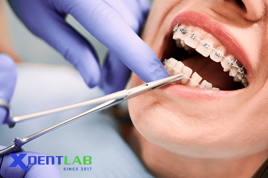 Clinical Applications and Treatment Considerations Clinical Applications and Treatment Considerations