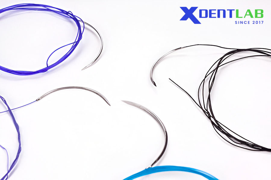 Types of Orthodontic Wire Materials