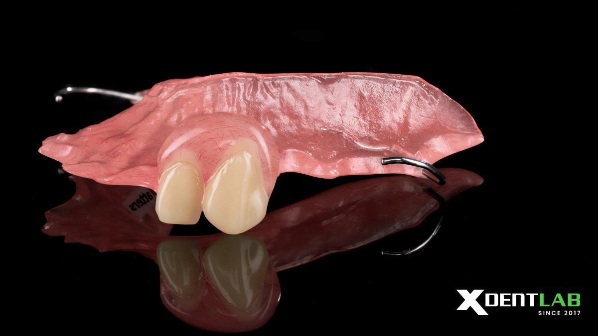 acrylic-removable-partial-denture-vietnam-dental-laboratory-xdentlab-10.png acrylic-removable-partial-denture-vietnam-dental-laboratory-xdentlab-10.png