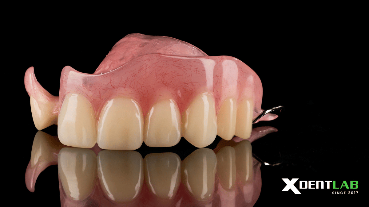 acrylic-removable-partial-denture-vietnam-dental-laboratory-xdentlab-2.png acrylic-removable-partial-denture-vietnam-dental-laboratory-xdentlab-2.png