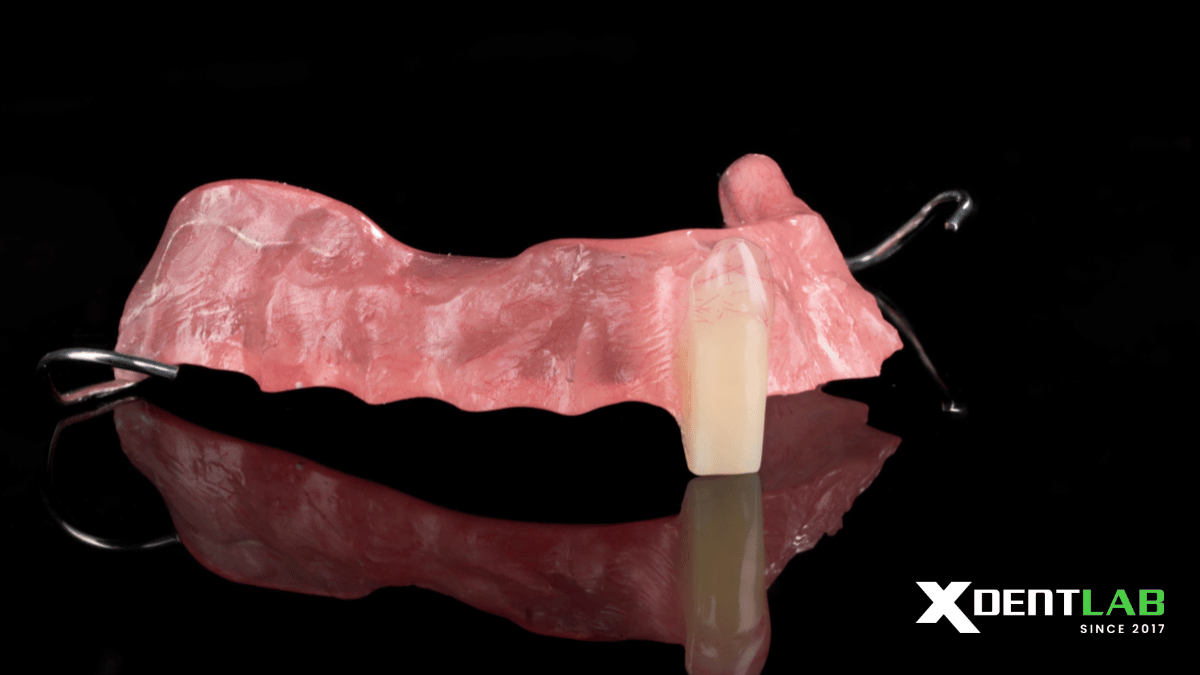 acrylic-removable-partial-denture-vietnam-dental-laboratory-xdentlab-3-1.png acrylic-removable-partial-denture-vietnam-dental-laboratory-xdentlab-3-1.png
