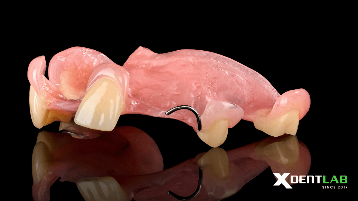 acrylic-removable-partial-denture-vietnam-dental-laboratory-xdentlab-4.png acrylic-removable-partial-denture-vietnam-dental-laboratory-xdentlab-4.png