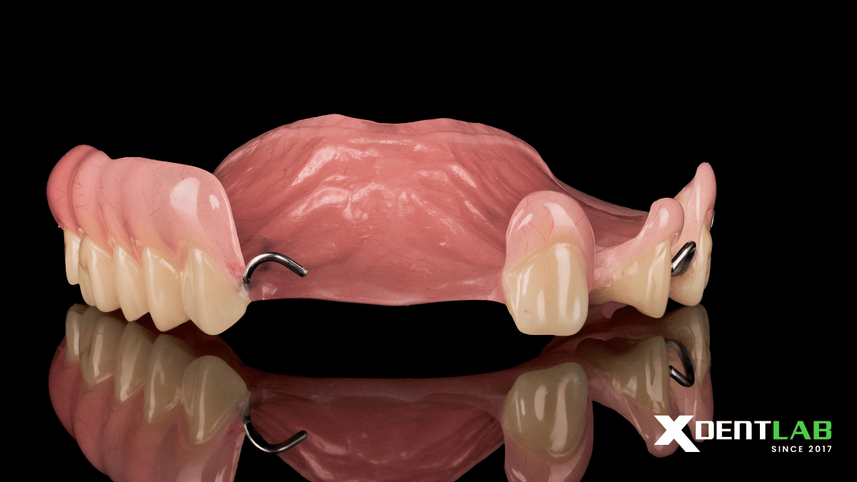 acrylic-removable-partial-denture-vietnam-dental-laboratory-xdentlab-8.png acrylic-removable-partial-denture-vietnam-dental-laboratory-xdentlab-8.png