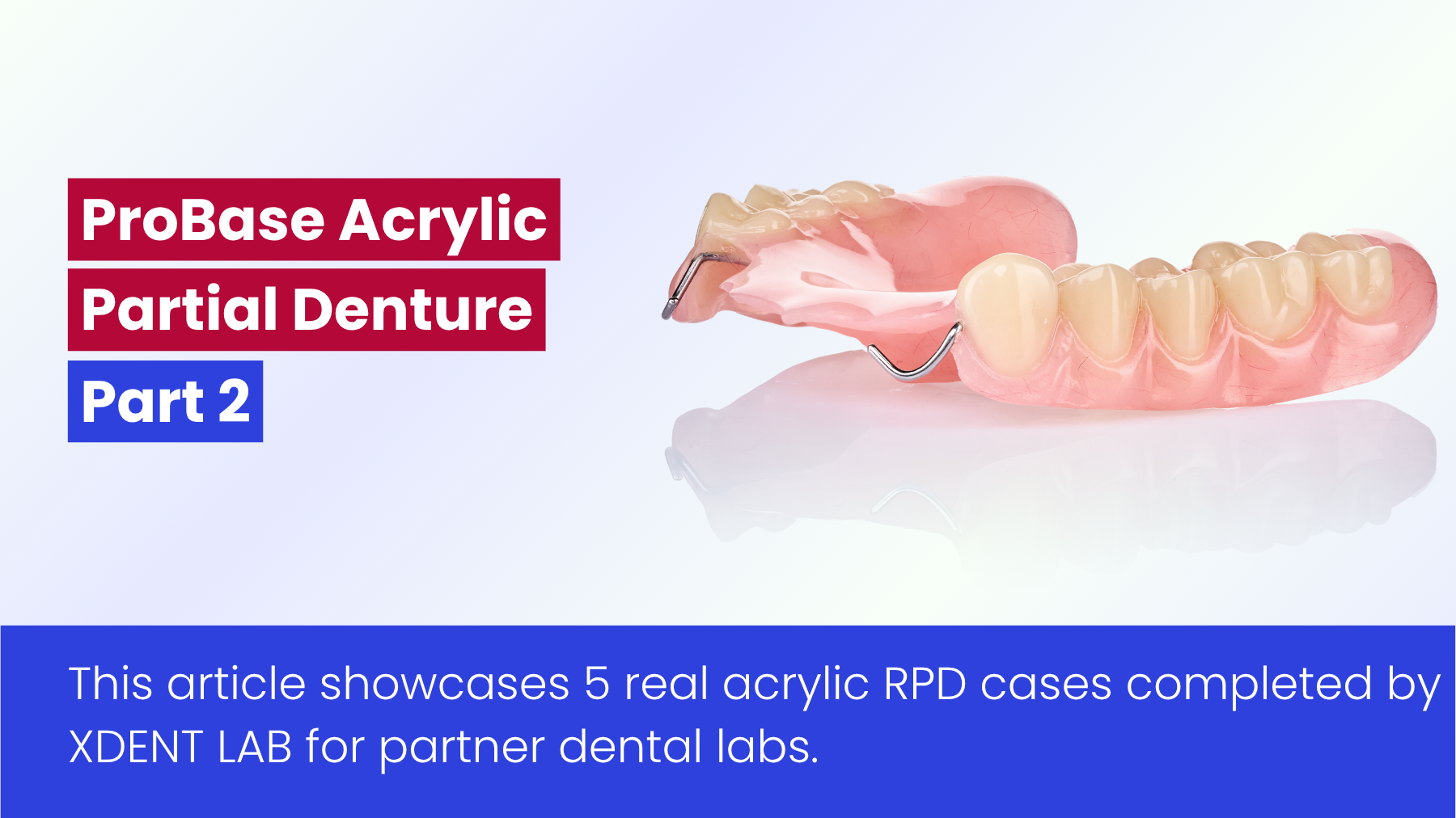 Acrylic Partial Denture Case By Vietnam Dental Lab – Outsourcing Service - Part 2