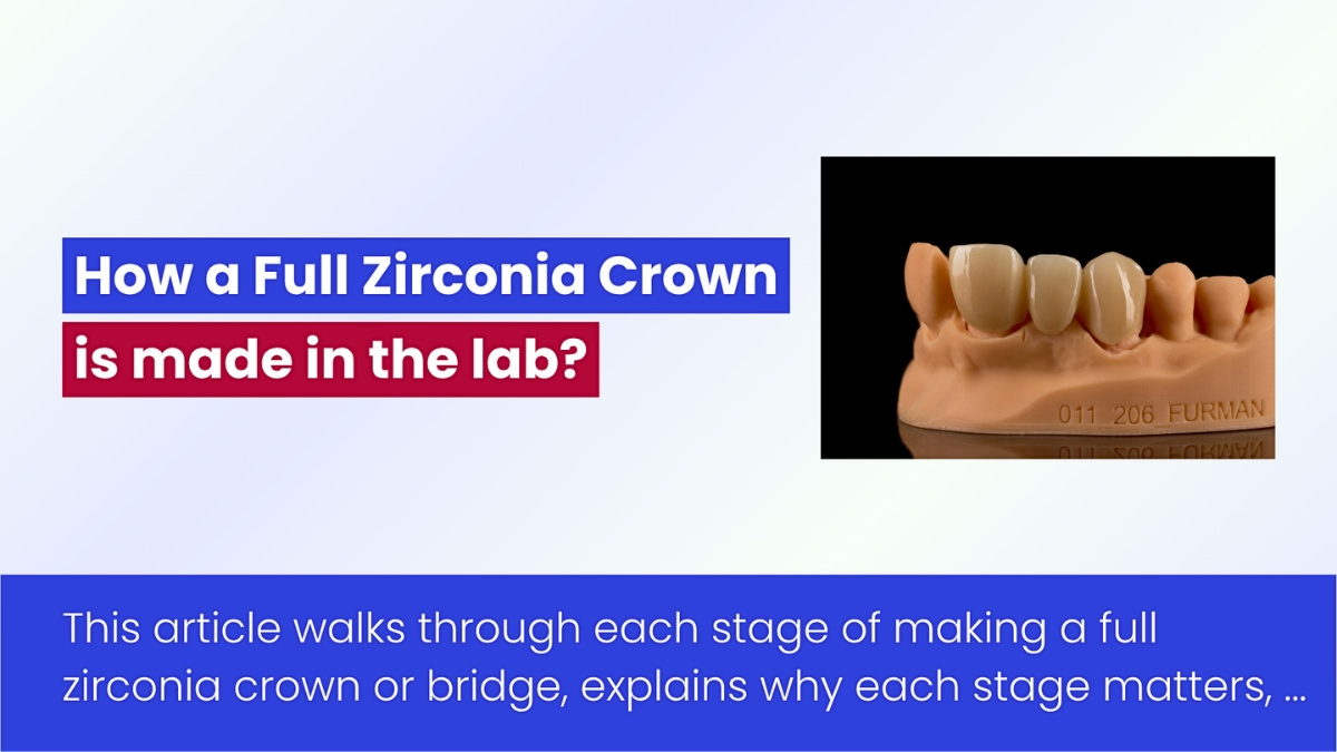 How A Full Zirconia Crown And Bridge Is Made: A Step-by-Step Guide