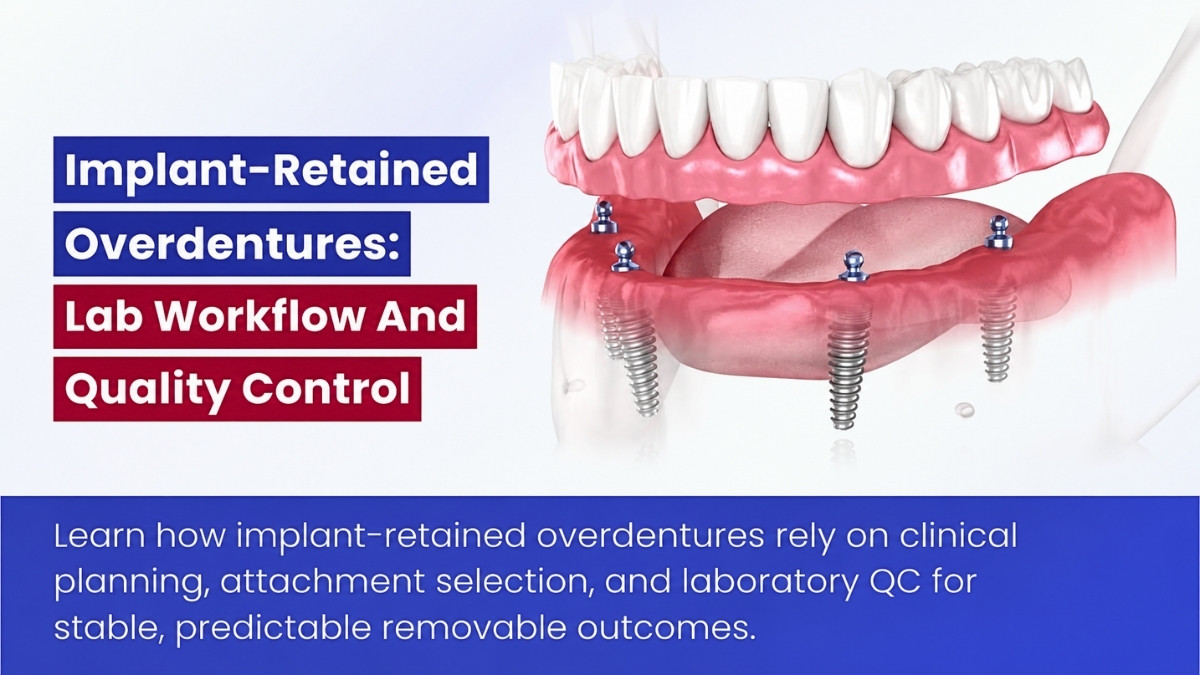 Implant-Retained Overdentures: Lab Workflow And Quality Control
