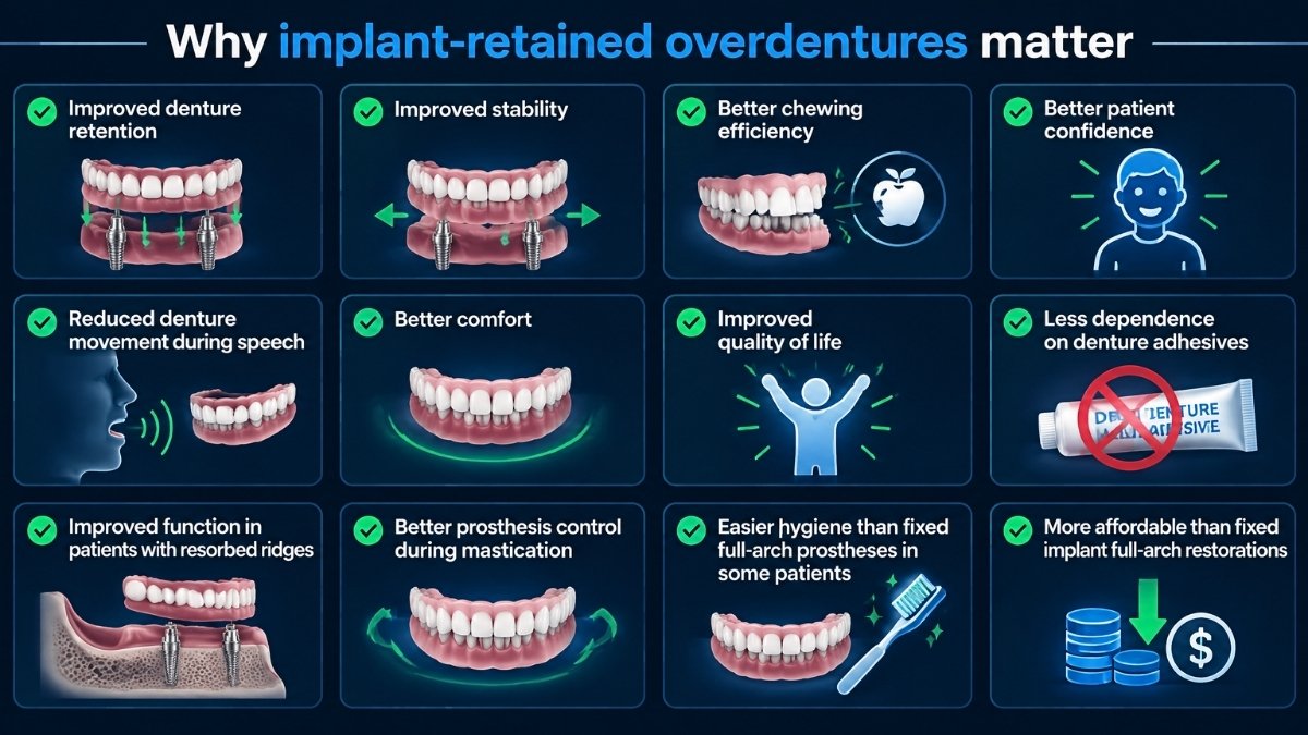 Why implant-retained overdentures matter