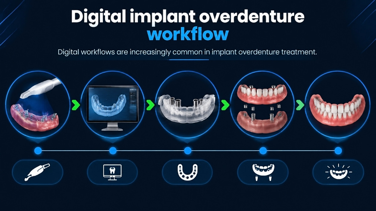 Digital implant overdenture workflow