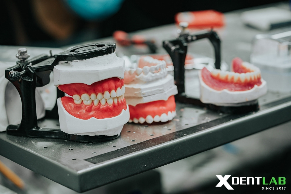 Why this matters for XDENT LAB
