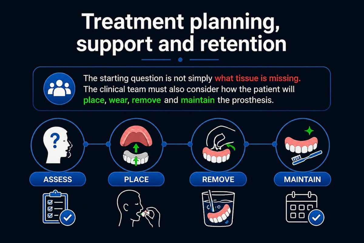 Treatment planning, support and retention Treatment planning, support and retention