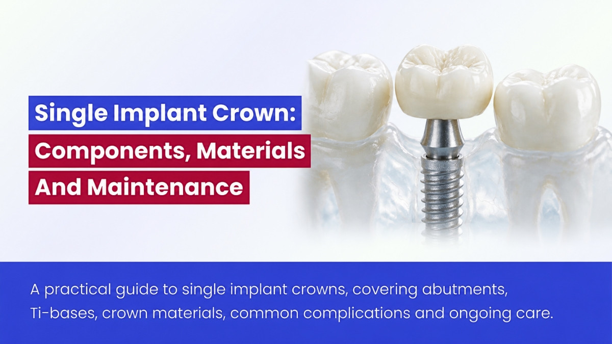 Single Implant Crown: Components, Materials And Maintenance