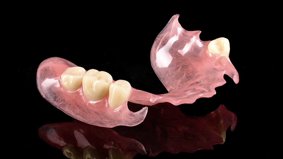 Acrylic Resin Denture Bases: Comprehensive Guide To PMMA Properties, Processing, And Performance