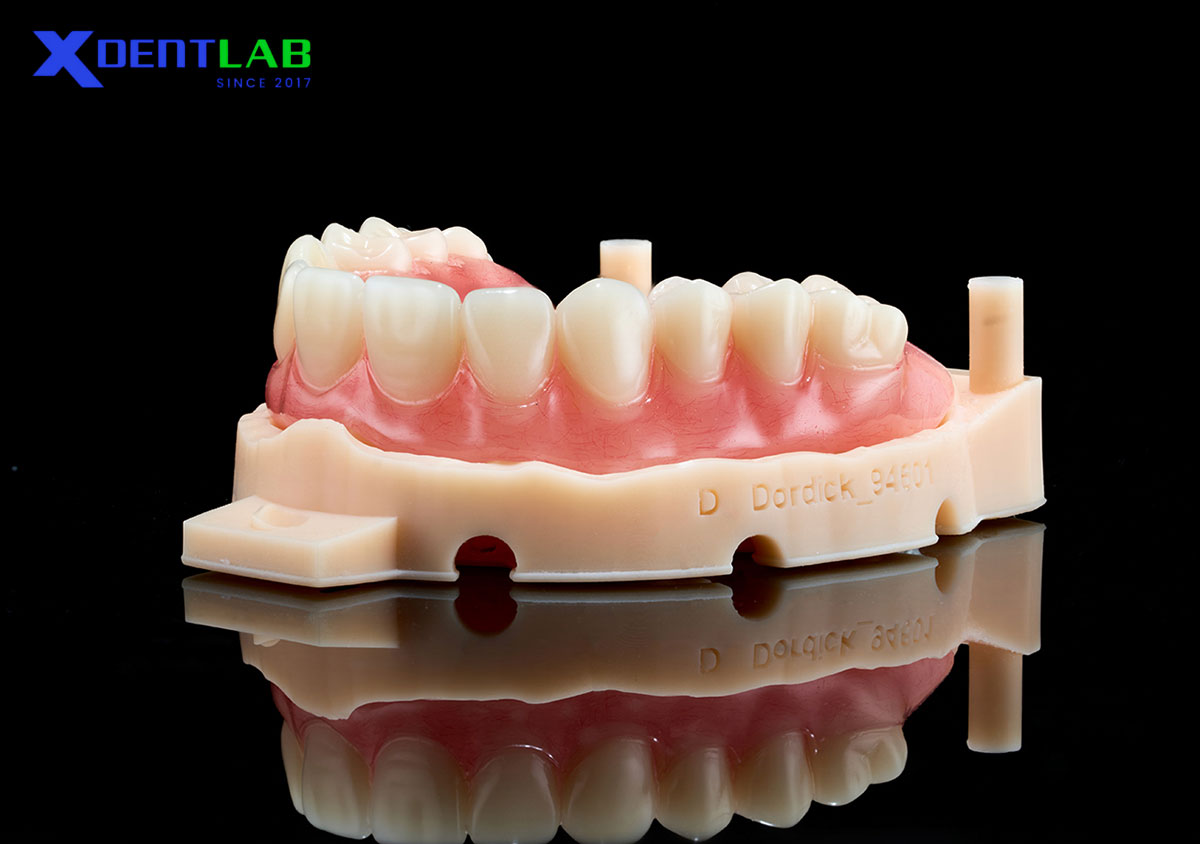 Practical Implications for Dental Laboratories Practical Implications for Dental Laboratories