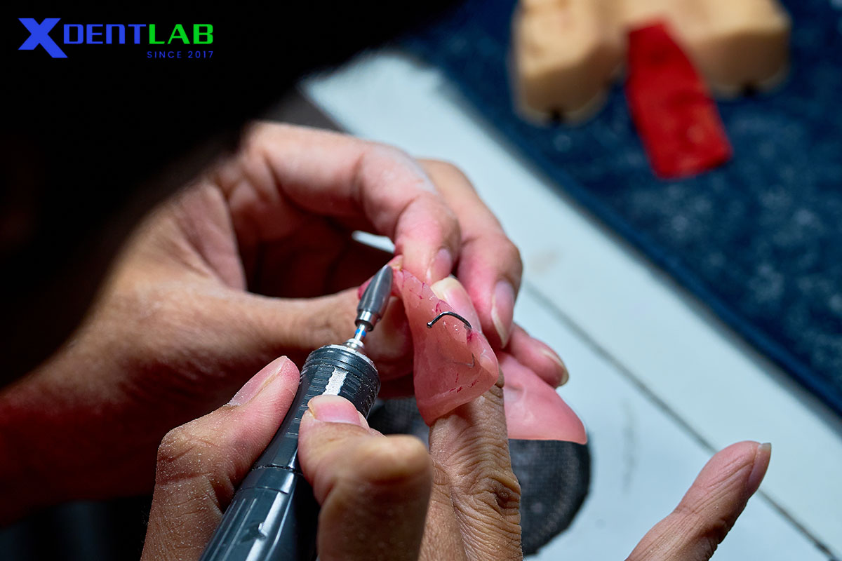 Thời Gian Xử Lý Trong Labo 2–3 Ngày Thời Gian Xử Lý Trong Labo 2–3 Ngày