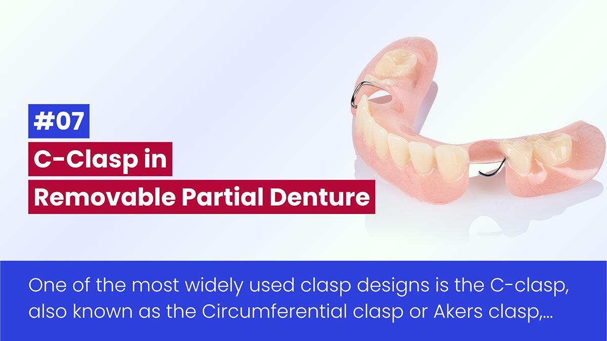 C-Clasp In RPD: Comprehensive Guide To Design, Function, And Clinical Application