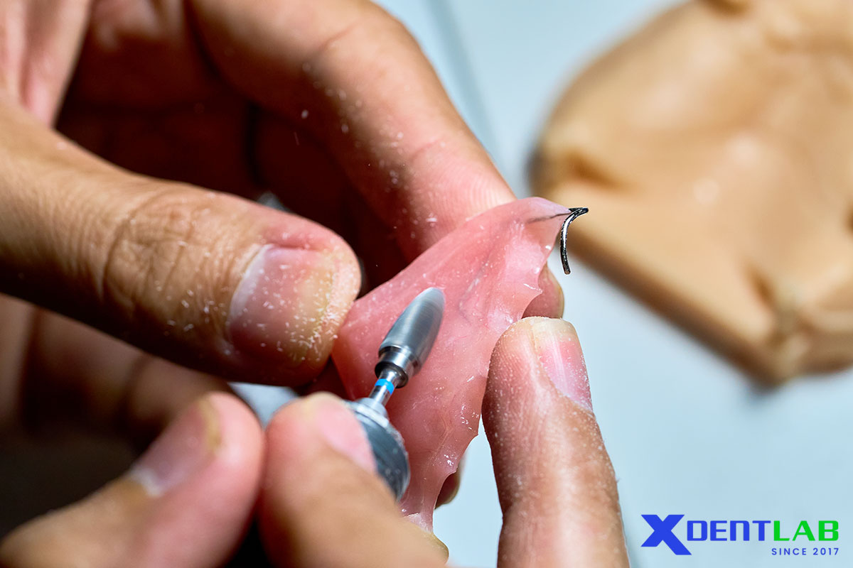 Importance of Proper Clasp Design