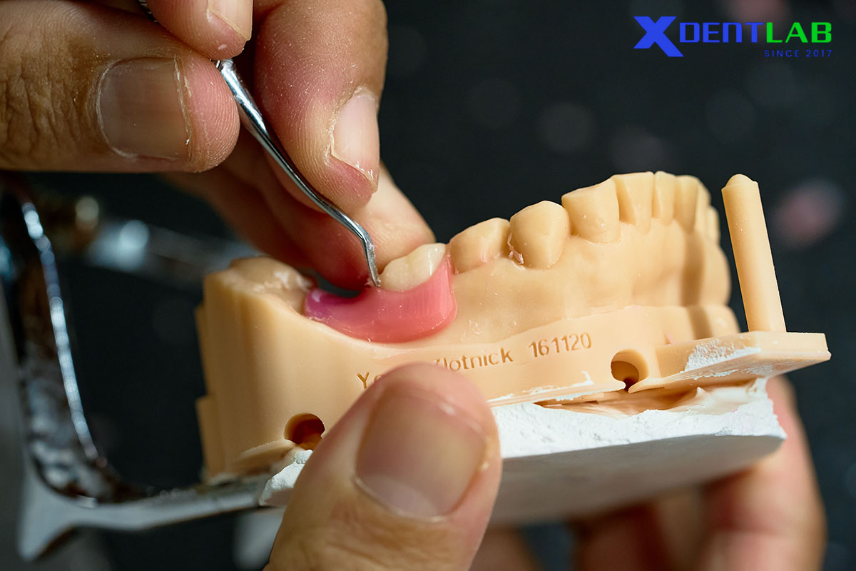 Vì Sao Gia Công Labo Nha Khoa Phát Triển Trên Toàn Thế Giới