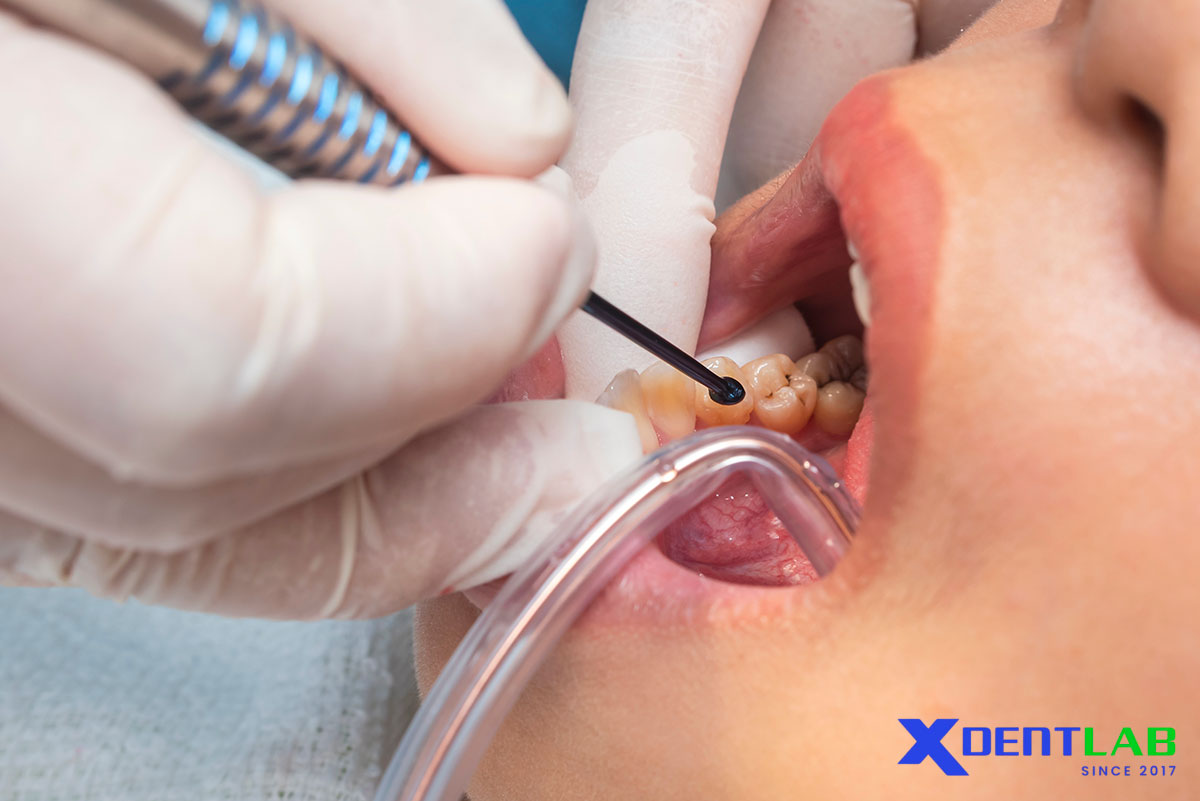 Clinical Protocol: Best Practices