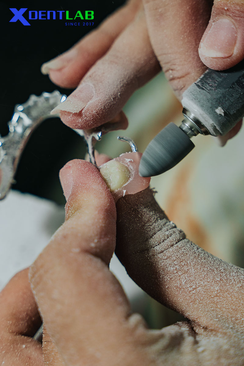 Ý nghĩa của thiết kế móc I-Bar đúng