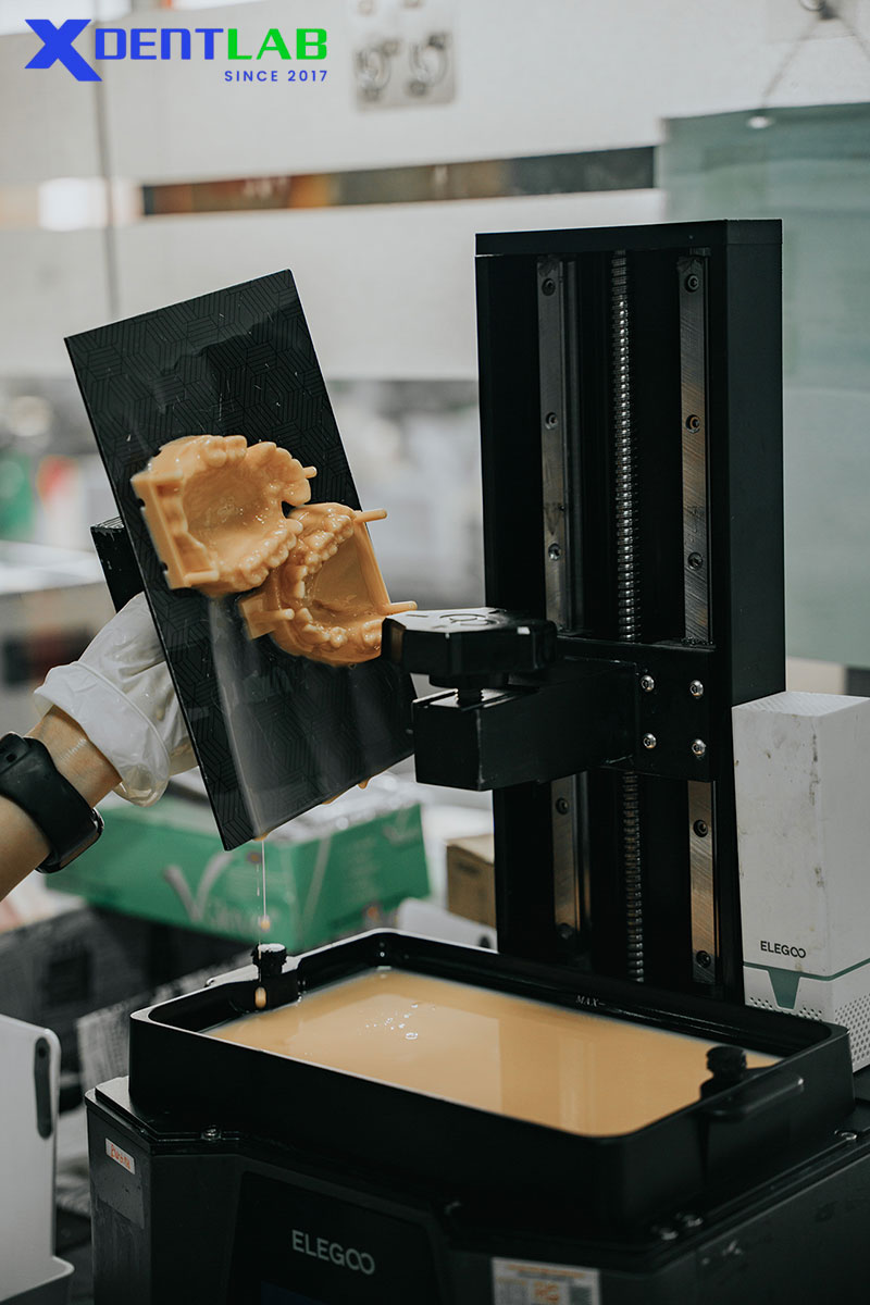 Workflows: Conventional, Digital, Hybrid