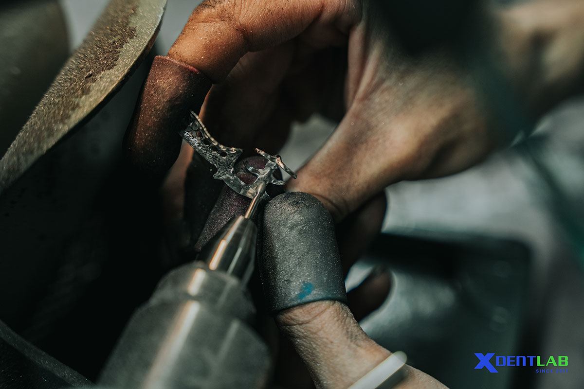 Lab To Lab Outsourcing – XDENT LAB: A Sustainable Growth Solution For Dental Laboratory Lab To Lab Outsourcing – XDENT LAB: A Sustainable Growth Solution For Dental Laboratory