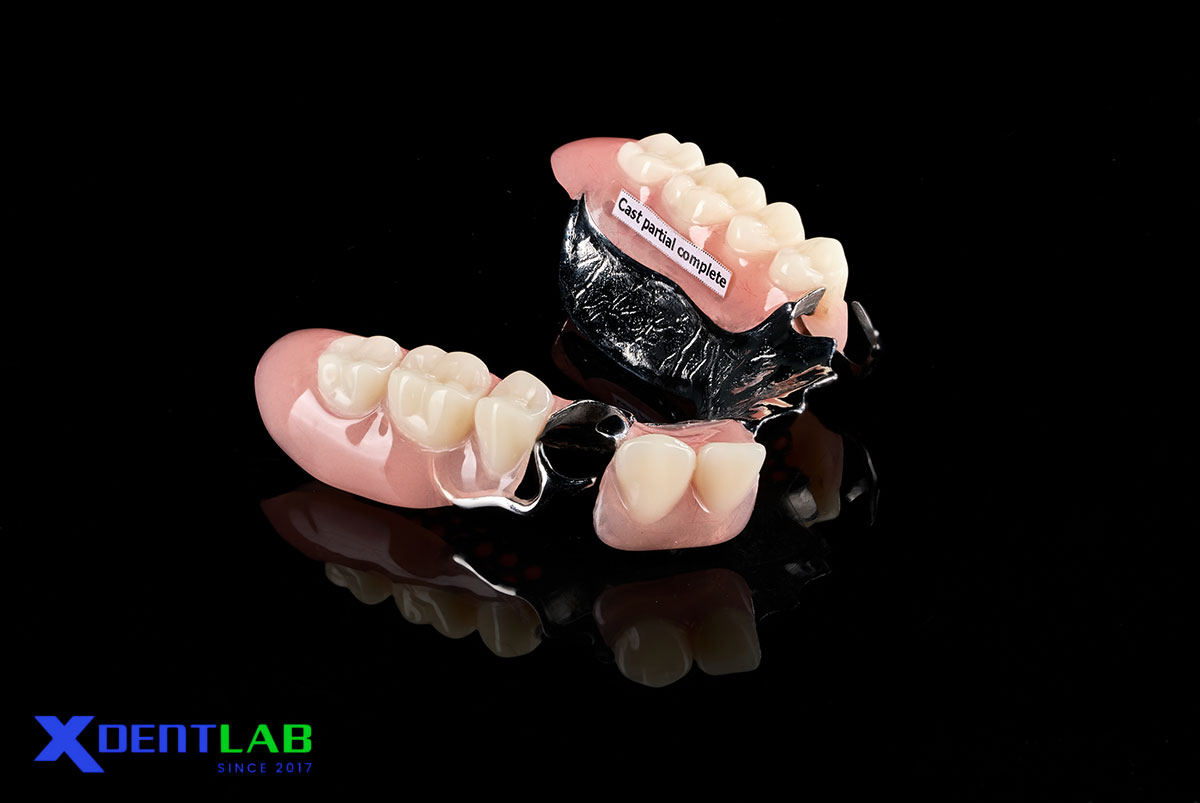 Roach Clasp In Removable Partial Denture: A Complete Guide Based On Clasp Classification