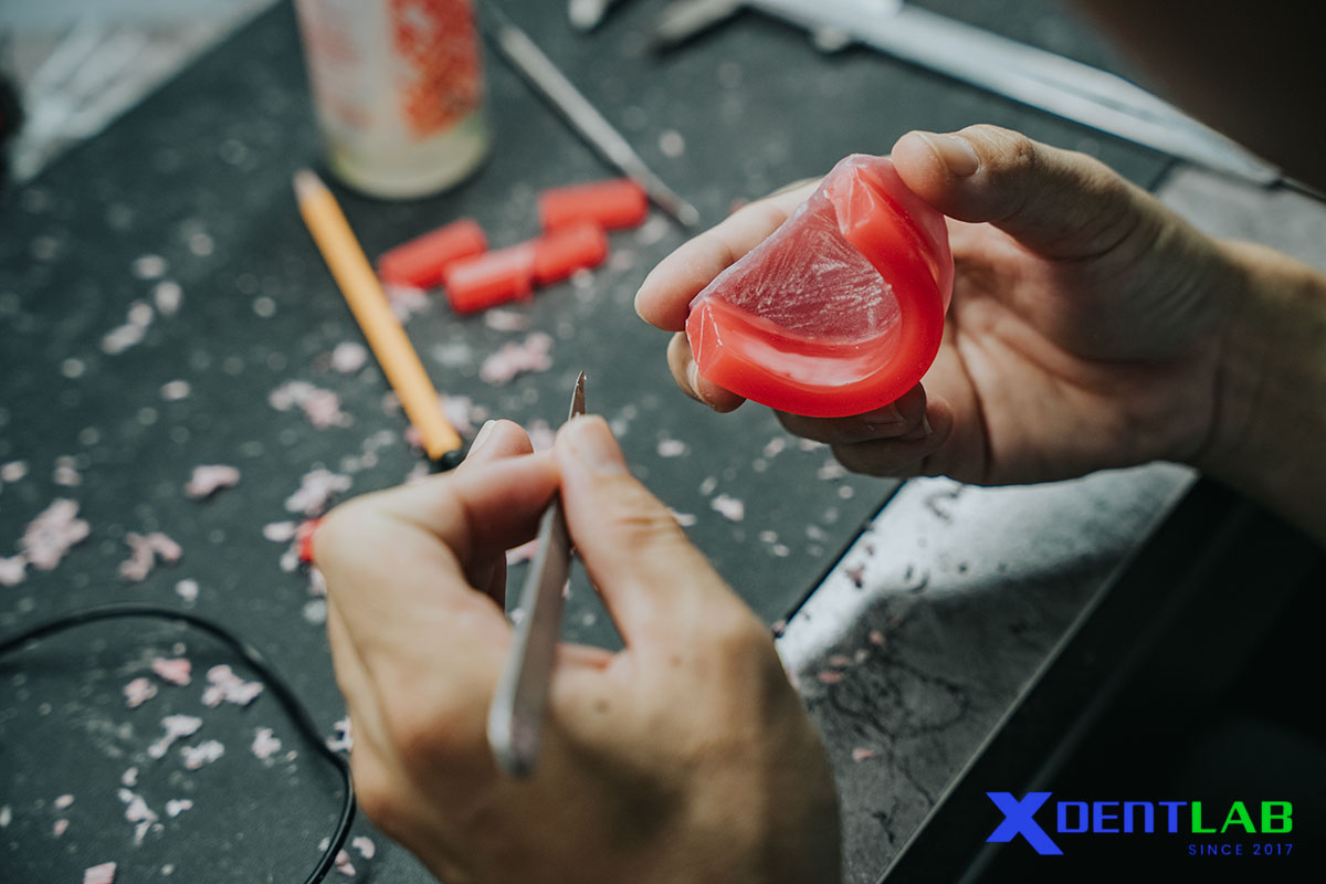 5 labo nha khoa nổi tiếng tại Ấn Độ thường được nhắc đến trên thị trường gia công nha khoa quốc tế 5 labo nha khoa nổi tiếng tại Ấn Độ thường được nhắc đến trên thị trường gia công nha khoa quốc tế