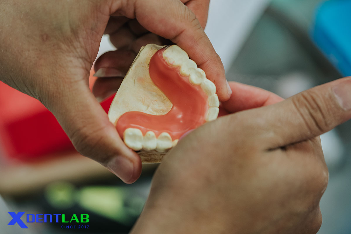 Ấn Độ đã khẳng định vị thế là điểm đến toàn cầu về dịch vụ labo nha khoa Ấn Độ đã khẳng định vị thế là điểm đến toàn cầu về dịch vụ labo nha khoa