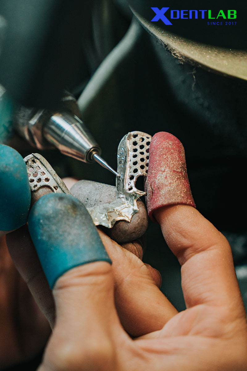 XDENT LAB – A Trusted Asia Outsourcing Dental Laboratory