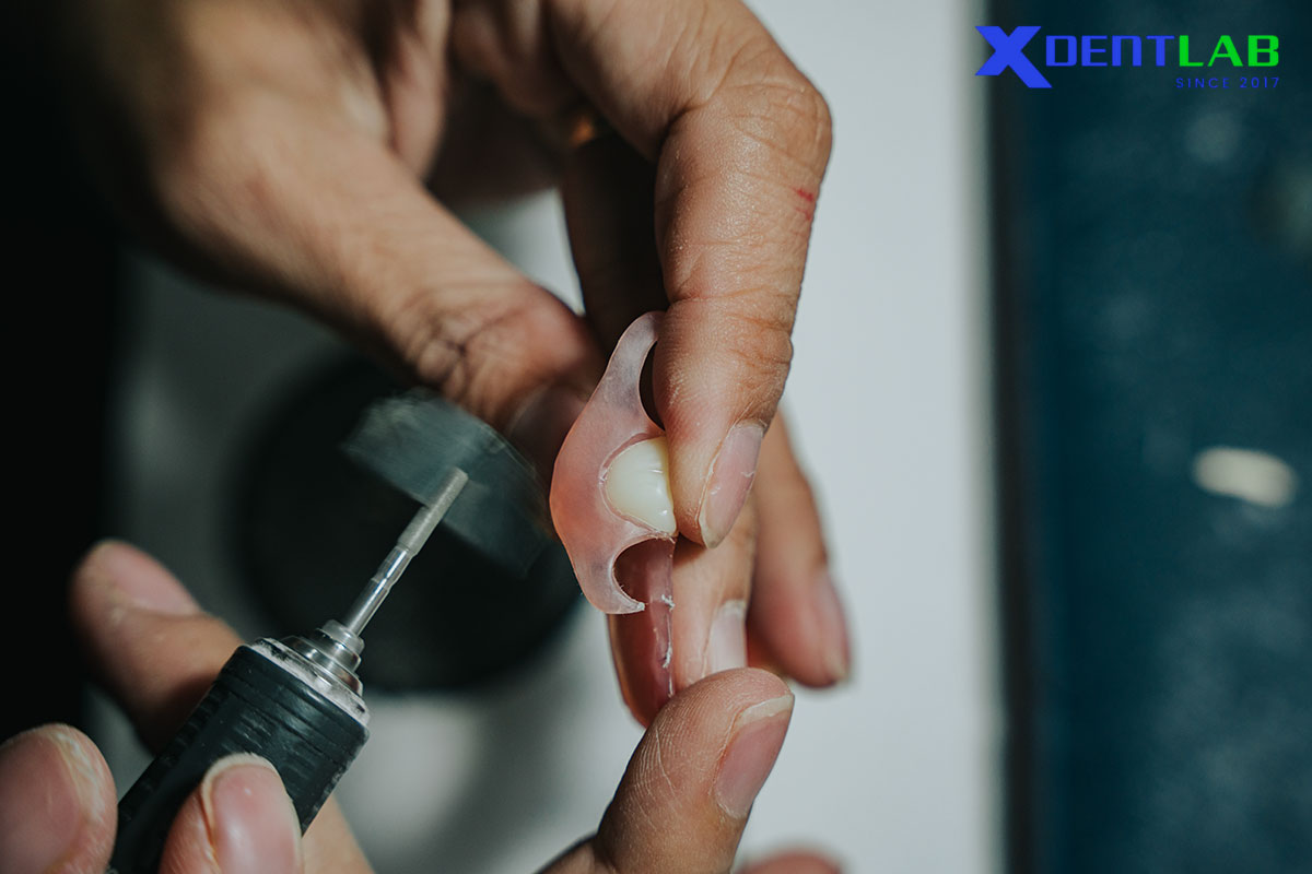 Lab Perspective Insight