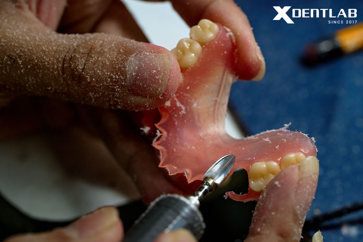 Current Trends in Removable Prosthodontics