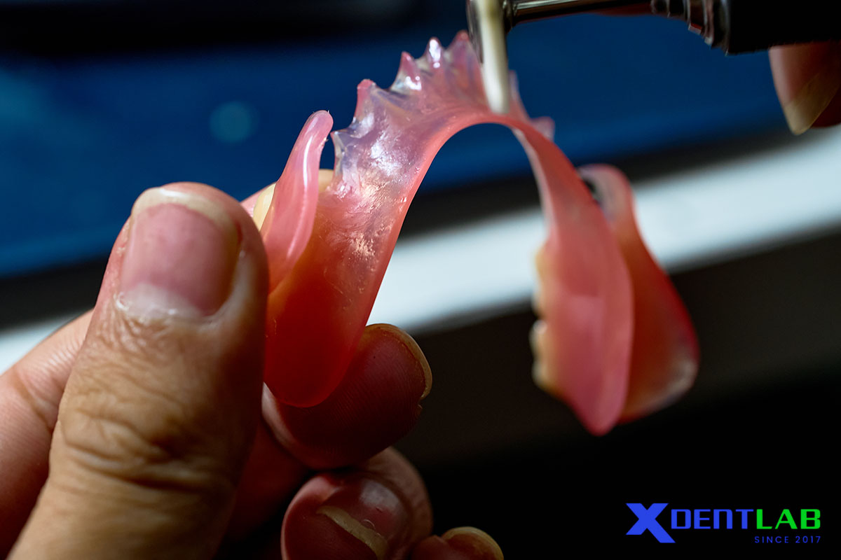 Flexible Clasp In Removable Partial Denture A Complete Clinical And Laboratory Guide
