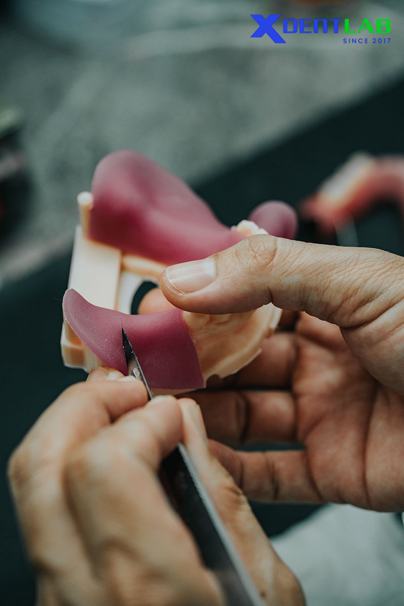 XDENT LAB Occlusal Rim Workflow