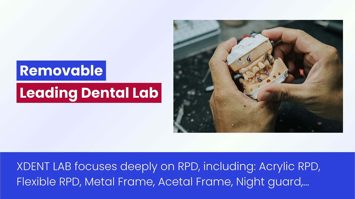 Removable Leading Dental Lab | XDENT LAB