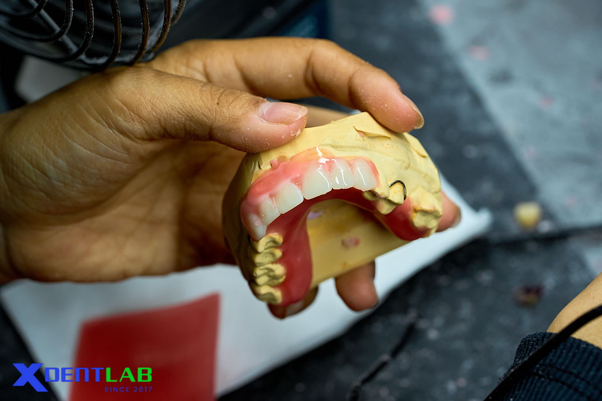 Why XDENT LAB is a Removable Leading Dental Lab Why XDENT LAB is a Removable Leading Dental Lab