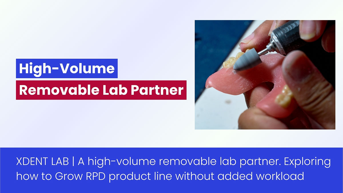 The Most Reliable High-Volume Removable Lab Partner