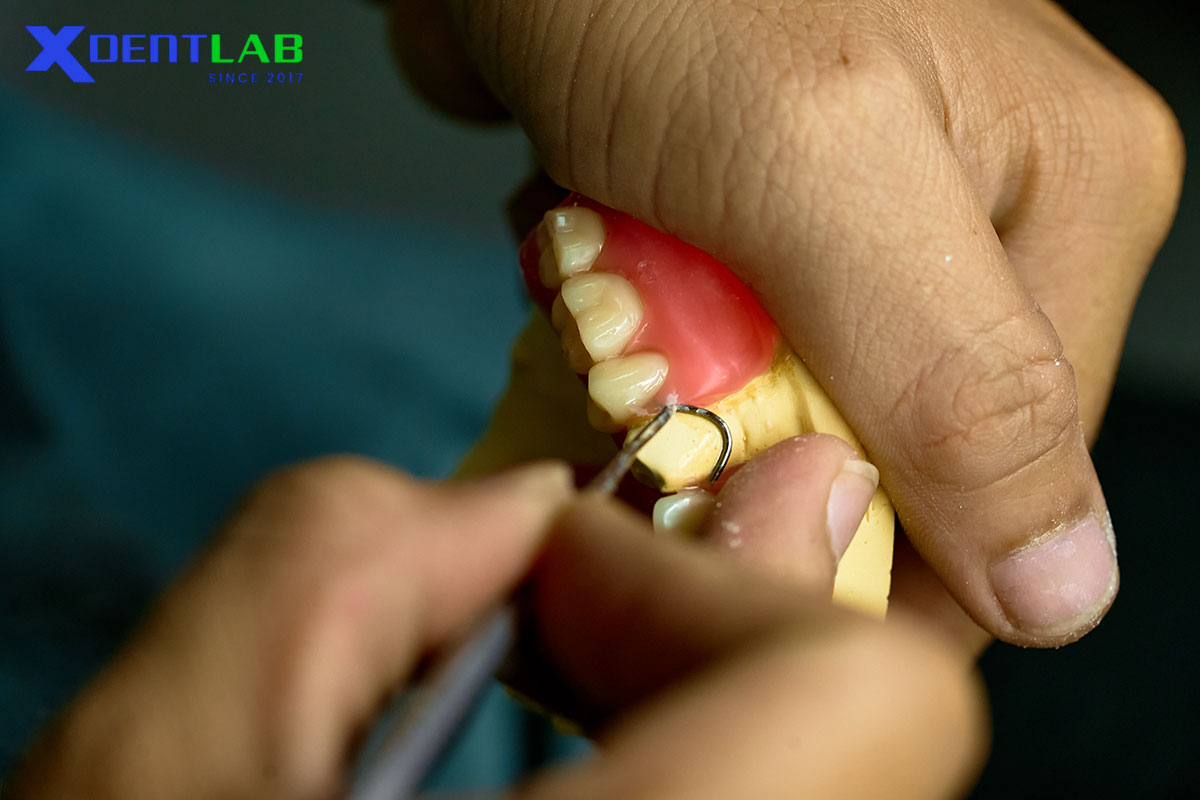 Strategy for labs looking to expand RPD without heavy investment Strategy for labs looking to expand RPD without heavy investment