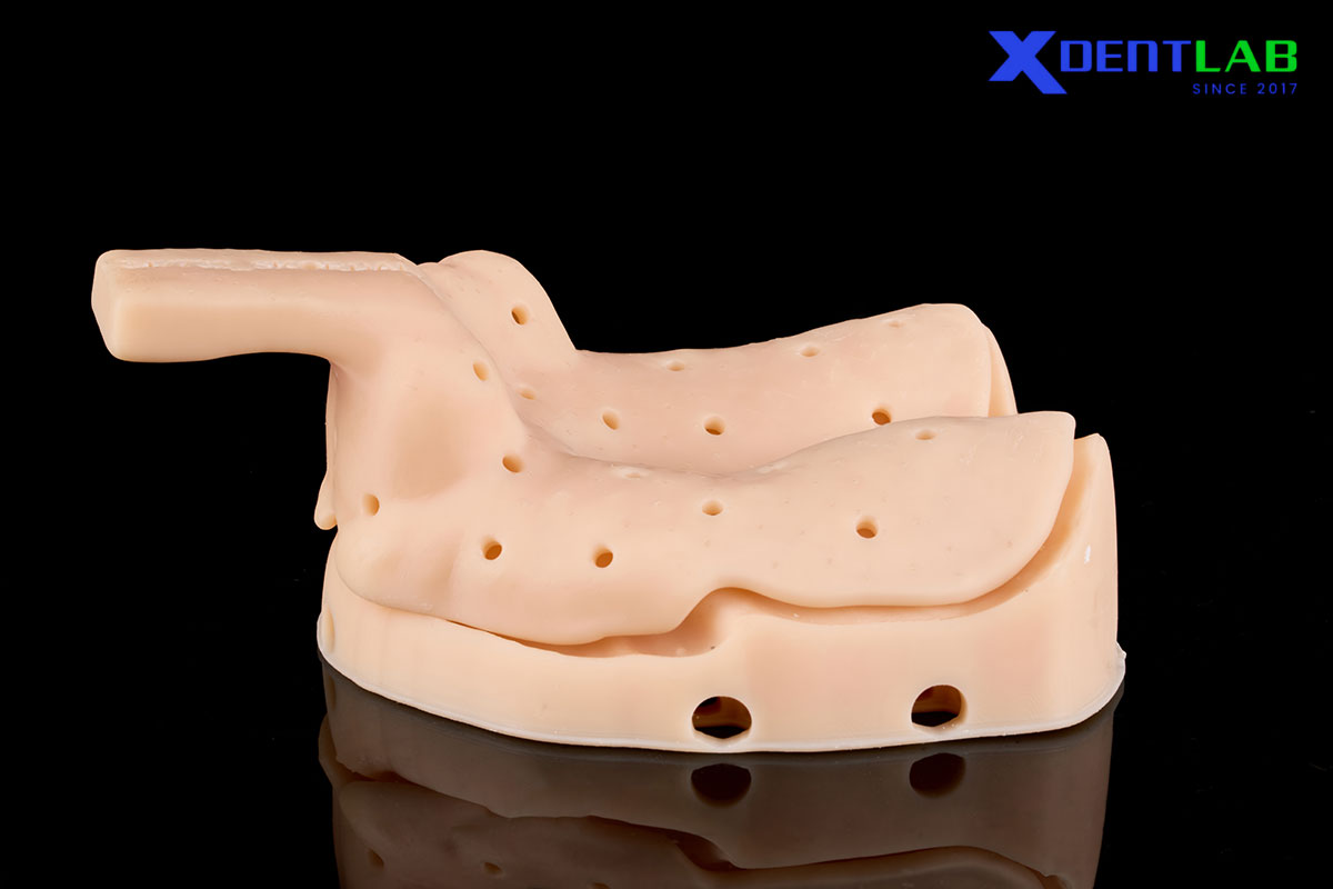 What is a 3D Printed Custom Tray?