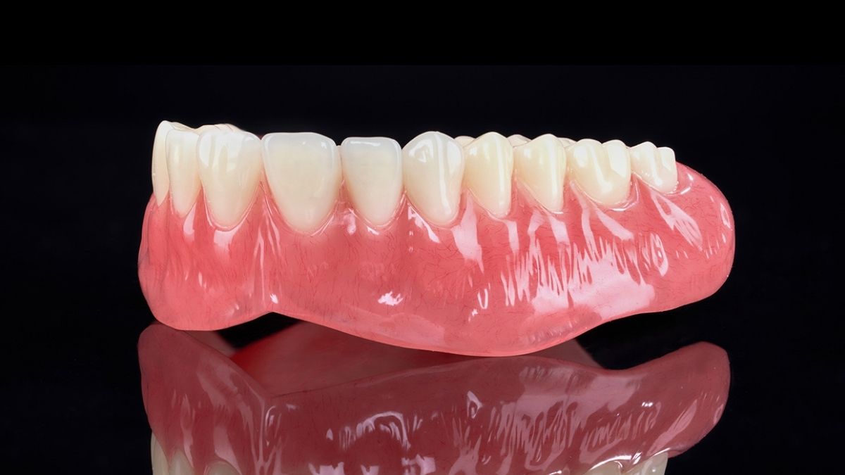 Aesthetic Removable Prosthetics: Comprehensive Overview Of Materials And Manufacturing