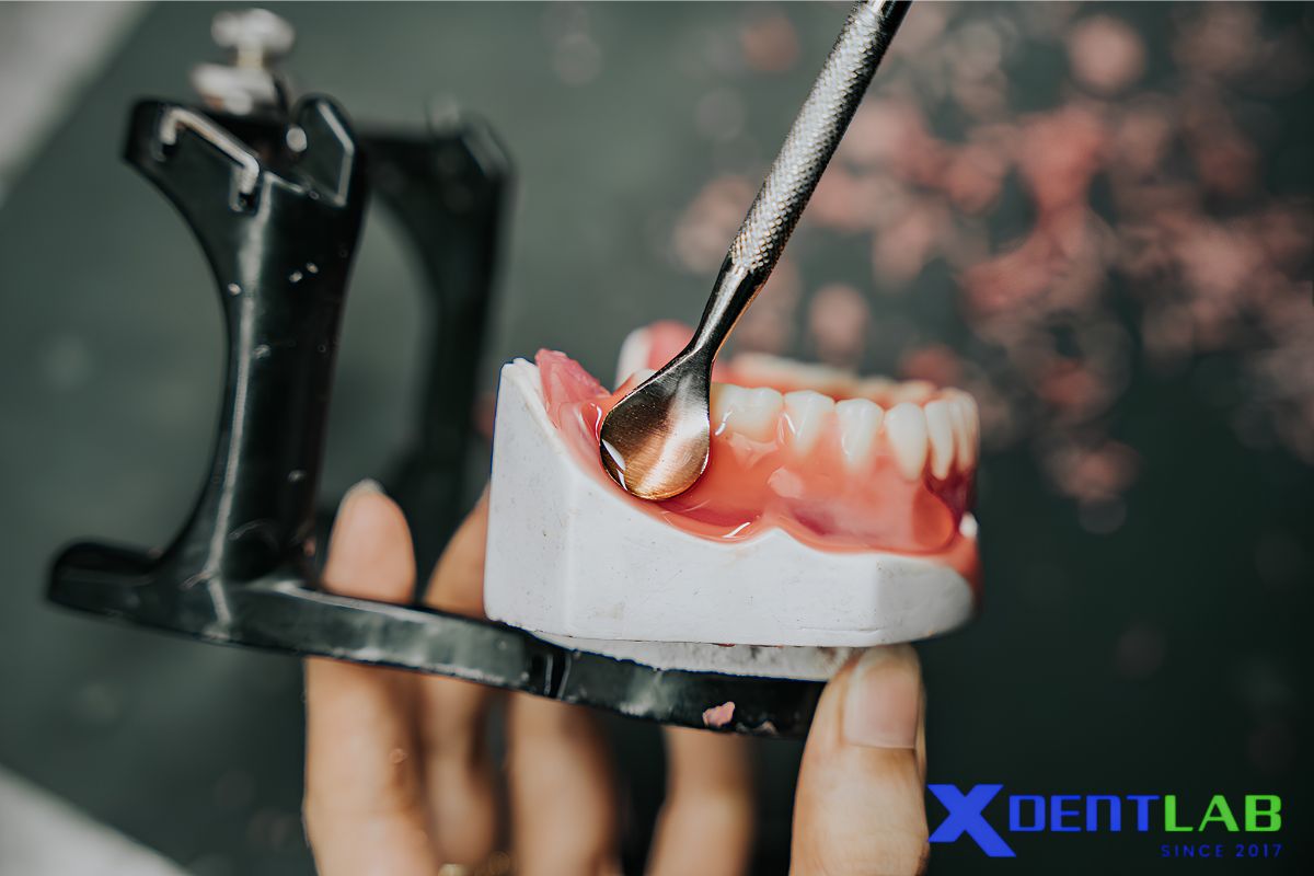 Why Aesthetic Removable Prosthetics Matter for Dental Labs and Outsourcing